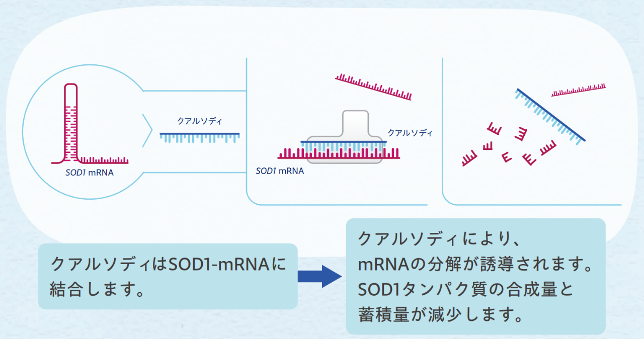 クアルソディはSOD1-mRNA