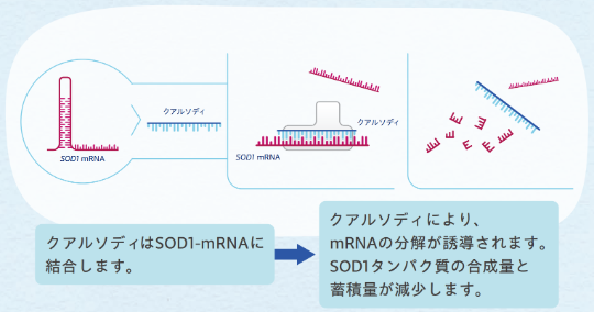 クアルソディはSOD1-mRNA
